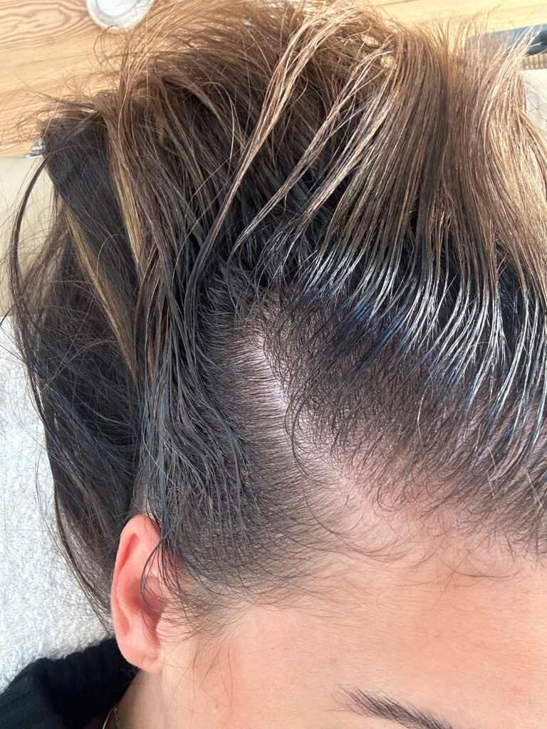Scalp Therapy: Haarwachstum fördern dank gesunder Kopfhaut 21